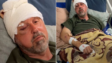 فلسطيني أميركي يقول إن مستوطنين اعتدوا عليه أثناء قطف الزيتون قرب رام الله — الجزيرة نت