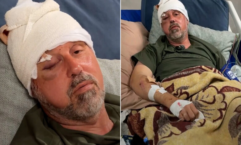 فلسطيني أميركي يقول إن مستوطنين اعتدوا عليه أثناء قطف الزيتون قرب رام الله — الجزيرة نت