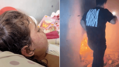 قصة إنقاذ طفلة من حريق أعقب قصفاً إسرائيلياً غرب غزة — الجزيرة نت
