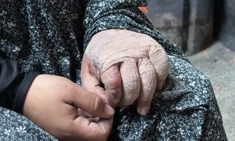 ذخائر غير منفجرة تهدد حياة سكان غزة وسط الركام والخيام — الجزيرة نت
